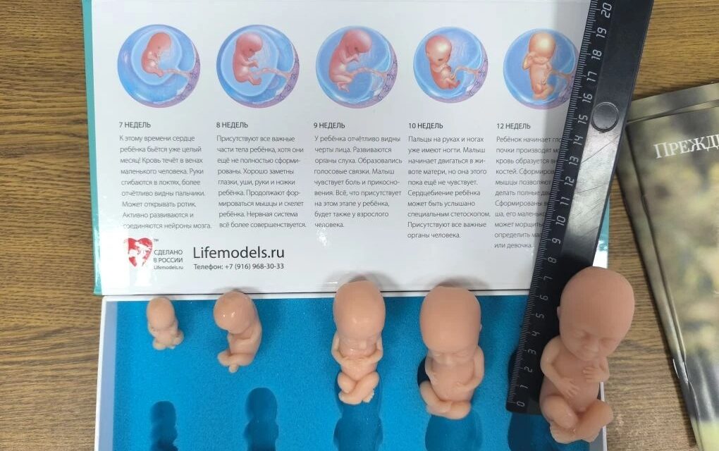 Это прекрасная новость! Поддержка и просвещение населения играют огромную роль в улучшении осведомленности о…